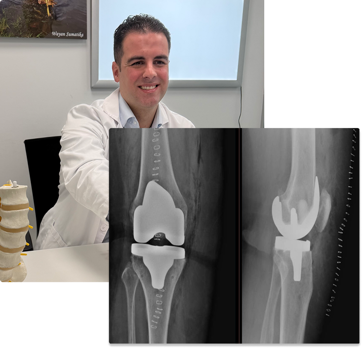 intervenciones